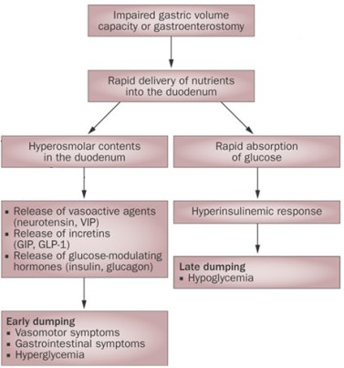 Dumping_Syndrome