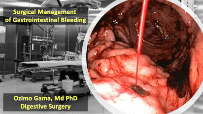 GI_Bleeding_Ozimo_Gama