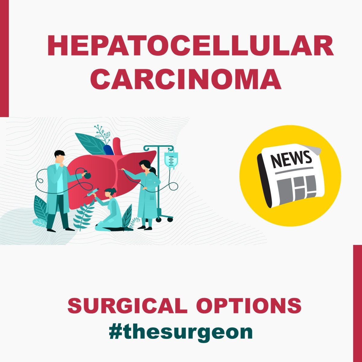 Surgical Options of Hepatocellular carcinoma | The SURGEON